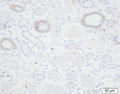 Immunohistochemistry detection of SCNN1G/Gamma-Subunit Epithelial Sodium Channel in human kidney tissue using Anti-SCNN1G/Gamma-Subunit Epithelial Sodium Channel Antibody (Cat. CAM 035-01-010). Tissue was mounted and pariffin fixed. Heat induced antigen retrieval was performed using citrate buffer, heated, and then blocked. After washing, the primary antibody (Cat. CAM 035-01-010) was incubated with the sample. Courtesy of Per Svenningsen, PhD.