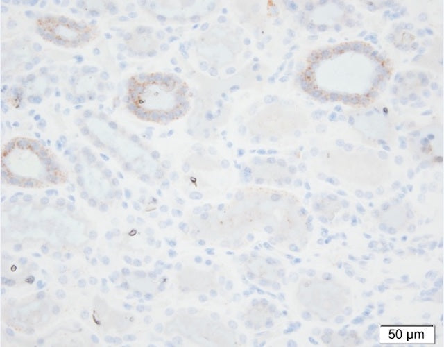 Immunohistochemistry detection of SCNN1G/Gamma-Subunit Epithelial Sodium Channel in human kidney tissue using Anti-SCNN1G/Gamma-Subunit Epithelial Sodium Channel Antibody (Cat. CAM 035-01-010). Tissue was mounted and pariffin fixed. Heat induced antigen retrieval was performed using citrate buffer, heated, and then blocked. After washing, the primary antibody (Cat. CAM 035-01-010) was incubated with the sample. Courtesy of Per Svenningsen, PhD.