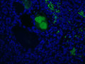Immunofluorescent staining of Complement C4c in Veins of human kidney with nephritis using Anti-Complement C4c Antibody (Cat. CAM 072-18-010). Cells where fixed with formaldehyde and permeabilized prior to staining Primary antibody (CAM 072-18-010) was incubated with the cells at a dilution of 1:200.