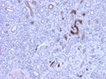 Immunohistochemistry detection of Complement C4c in human kidney tissue using Anti-Complement C4c Antibody (Cat. CAM 072-18-010). Tissue was mounted and pariffin fixed. Heat induced antigen retrieval was performed using citrate buffer, heated, and then blocked. After washing, the primary antibody (Cat. CAM 072-18-010) was incubated with the sample at a dilution of 1:600. Strong staining of veins of nephritis kidney.