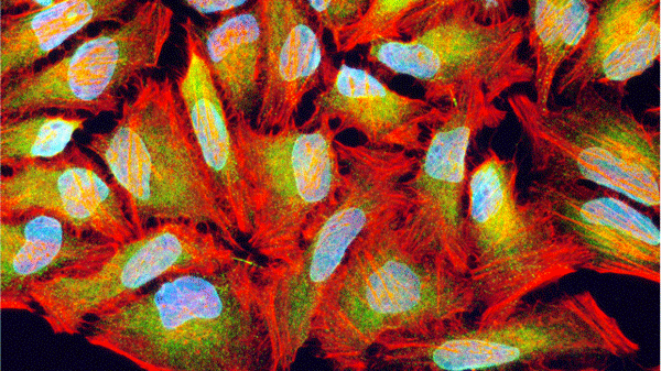 Canx Anti-Calnexin Antibody | CANX-0100