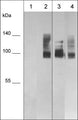 Western blot analysis of denatured (lanes 1 & 3) and native (lanes 2 & 4) human MDA-MB-231 whole cell lysates. The blots were probed with mouse monoclonal anti-CD44 (CM5881) at 1:1000 (lanes 1 & 2) or mouse monoclonal anti-CD44 (CM5911) at 1:1000 (lanes 3 & 4).