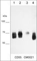 Immunocytochemical labeling of CD55 in paraformaldehyde fixed human MDA-MB-231 breast cancer cells. The cells were labeled with mouse monoclonal anti-CD55 (CM0021). The antibody was detected using goat anti-mouse DyLight® 594.