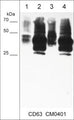 Immunocytochemical labeling of CD63 in paraformaldehyde fixed human MeWo melanoma cells. The cells were labeled with mouse monoclonal CD63 (CM0401). The antibody was detected using goat anti-mouse Ig DyLight® 594.