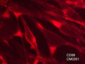 Immunocytochemical labeling of CD99 in paraformaldehyde fixed human MeWo cells. The cells were labeled with mouse monoclonal anti-CD99 (clone M026). The antibody was detected using goat anti-mouse DyLight® 594.