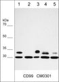 Immunocytochemical labeling of CD99 in paraformaldehyde fixed human MeWo cells. The cells were labeled with mouse monoclonal anti-CD99 (clone M030). The antibody was detected using goat anti-mouse DyLight® 594.