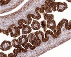 Formalin fixed, citric acid treated parafin sections of embryonic Rat E16 intestines. Sections were probed with anti-β-Catenin (CM1181) then anti-mouse:HRP before detection using DAB. (Images provided by Carl Hobbs and Dr. Pat Doherty at Wolfson Centre for Age-Related Diseases, King's College London).
