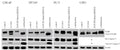 Induction of apoptosis after combination treatment was marked by poly (ADP-ribose) polymerase (PARP) cleavage and caspase-3 (Cat. CM4911) activation. Western blots of single or combination treatment of LNCaP (48 h), DU145, PC-3 or CHO cells (all 72 h)