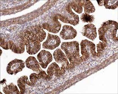 Formalin fixed, citric acid treated parafin sections of embryonic Rat E16 intestines. Sections were probed with anti-β-Catenin (CP1061) then anti-Rabbit:HRP before detection using DAB. (Images provided by Carl Hobbs and Dr. Pat Doherty at Wolfson Centre for Age-Related Diseases, King's College London).