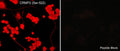 Immunocytochemical labeling of CRMP2 phosphorylation in aldehyde-fixed and NP-40-permeabilized NGF-differentiated PC12 cells. The cells were labeled with rabbit polyclonal anti-CRMP2 (Ser-522) (CP2191) antibody in the absence (Left) or presence (Right) of blocking peptide (CX2195). The antibody was detected using appropriate secondary antibody conjugated to DyLight® 594.