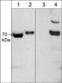 Western blot of rat PC12 cells untreated (lanes 1 & 3) or treated with calyculin A (lanes 2 & 4). The blot was probed with anti-CRMP2 (C-terminal Region) antibody (lanes 1 & 2) or anti-CRMP2 (Thr-555) antibody (lanes 3 & 4).