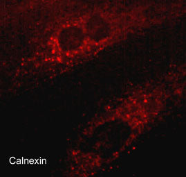 Immunocytochemical labeling in paraformaldehyde fixed and NP-40 permeabilized rat A7r5 cells. The cells were labeled with mouse monoclonal Anti-Calnexin (CM4371), then the antibody was detected using Goat anti-Mouse secondary antibody conjugated to DyLight® 594.