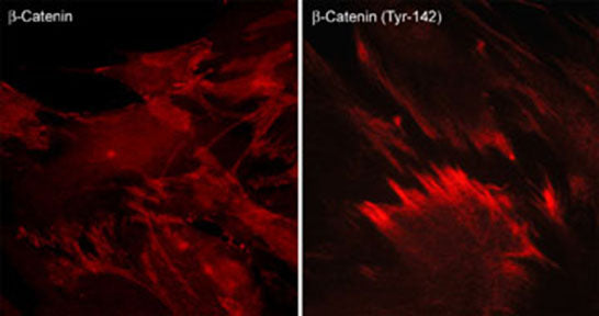 Immunocytochemical labeling of phosphorylated β-Catenin in paraformaldehyde-fixed and NP-40-permeabilized rabbit spleen fibroblasts. The cells were labeled with mouse monoclonal β-Catenin and rabbit polyclonal β-Catenin (Tyr-142) antibodies, then the antibodies were detected using appropriate secondary antibodies conjugated to Cy3.