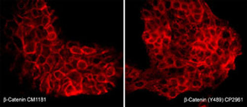 Immunocytochemical labeling of β-Catenin in pervanadate-treated A431 cells. The cells were labeled with mouse monoclonal β-Catenin (CM1181) or rabbit polyclonal β-Catenin (Tyr-489) antibodies, then the antibodies were detected using appropriate secondary antibodies conjugated to Cy3.