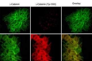 Immunocytochemical labeling of phosphorylated γ-Catenin in control (Top) and pervanadate-treated (Bottom) A431 cells. The cells were co-labeled with mouse monoclonal γ-Catenin (CM1111) or rabbit polyclonal γ-Catenin (Tyr-550) antibodies, then the antibodies were detected using appropriate secondary antibodies conjugated to Cy2 or Cy3.