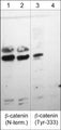  Western blot analysis of A431 cells stimulated with pervanadate (1 mM) for 30 min (lanes 1 & 3) then treated with akaline phosphatase (lanes 2 & 4). The blot was probed with CP1061 anti-β-Catenin (CP1061) (lanes 1 & 2) and CP3051 anti-β-Catenin (Tyr-333) (lanes 3 & 4).