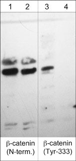  Western blot analysis of A431 cells stimulated with pervanadate (1 mM) for 30 min (lanes 1 & 3) then treated with akaline phosphatase (lanes 2 & 4). The blot was probed with CP1061 anti-β-Catenin (CP1061) (lanes 1 & 2) and CP3051 anti-β-Catenin (Tyr-333) (lanes 3 & 4).