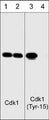 Western blot analysis of human SYF fibroblasts before (lanes 1 & 3) and after (lanes 2 & 4) treatment with alkaline phosphatase. The blots were probed with anti-Cdk1 (N-terminal region) antibody (lanes 1 & 2) or anti-Cdk1 (Tyr-15) phospho-specific antibody (lanes 3 & 4).