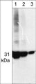 Western blot analysis of human HeLa cells. The blot was probed with anti-Cdk5 (CM2361) antibody at 1:250 (lane 1), 1:1000 (lane 2), and 1:4000.(lane 3).