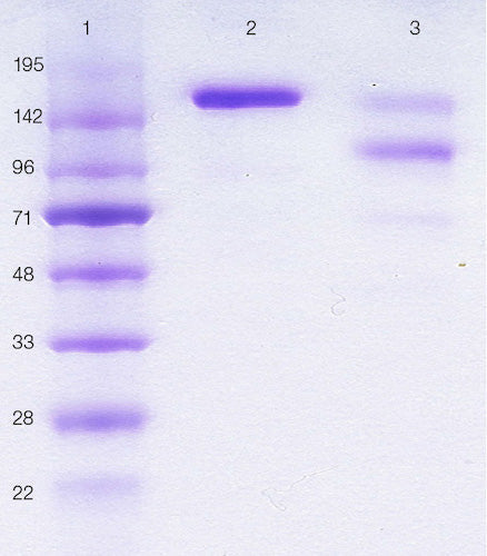 Lane 1 shows molecular weight markers, lane 2 DIA HE1 purified human IgE 185 kDa, lane 3 shows IgE, purified from human serum from a myeloma patient.