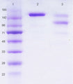 Lane 1 shows molecular weight markers, lane 2 DIA HE1 purified human IgE 185 kDa, lane 3 shows IgE, purified from human serum from a myeloma patient.