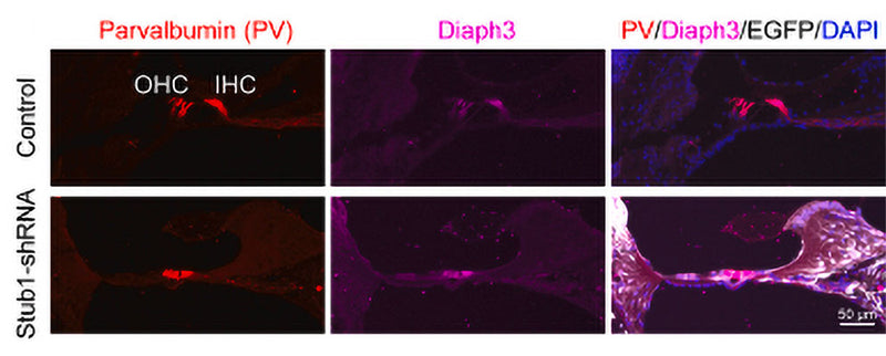 Immunofluorescent images showing Parvalbumin (hair cells, red) and Diaph3 (Cat no DP3491, 1:400, magenta) expression in cryo-sectioned cochlea (organ of Corti area). The knockdown of the endogenous Stub1 in mouse inner ear leads to severe hearing loss. AAV-ie vector containing GFP tag was used to package Stub1-shRNA. The left ear of P3 mice were injected with AAV-ie via round window membrane (RWM). Image from publication, CC-BY-4.0. PMID: 39322015.