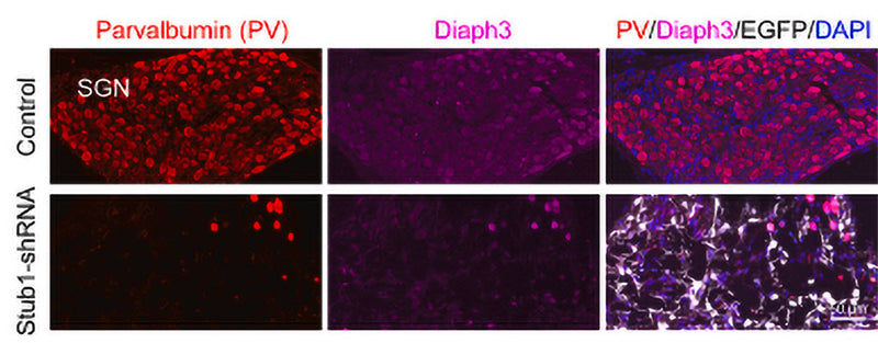 Immunofluorescent images showing Parvalbumin (SGNs, red) and Diaph3 (Cat no DP3491, 1:400, magenta) expressions in cryo-sectioned cochlea (SGN area).The knockdown of the endogenous Stub1 in mouse inner ear leads to severe hearing loss. AAV-ie vector containing GFP tag was used to package Stub1-shRNA. The left ear of P3 mice were injected with AAV-ie via round window membrane (RWM). Image from publication, CC-BY-4.0. PMID: 39322015.