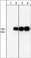 Western blot image of human A431 cells untreated (lanes 1 & 3) or treated with EGF (100 ng/ml) for 5 min. The blot was probed with anti-EGFR (Tyr-1101) monoclonal antibody (lanes 1 & 2) or anti-EGFR (Cytoplasmic) monoclonal antibody (lanes 3 & 4).