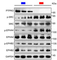 Immunoblotting of PTPRO, p-SRC, SRC, p-EPHA4 (Cat. EP2731, 1:1000), EPHA4, p-EPHB2, and EPHB2 in Ptpro+/+ and Ptpro–/– mice hippocampi under Chemotherapy-related cognitive impairment (CRCI). Image from publication CC-BY-4.0.