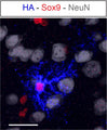 Representative image of astrocyte transduced with AAV, labeled with HA (Cat. ET-HA100; blue) and astrocytemarker (Sox9). Neurons are identified by NeuN staining. Image from publication CC-BY-4.0. PMID:38574730