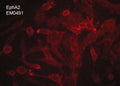 Immunocytochemical labeling of EphA2 in aldehyde fixed human MDA-MB-231 breast carcinoma cells. The cells were labeled with mouse monoclonal anti-EphA2 (EM0491). The antibody was detected using goat anti-mouse DyLight® 594.