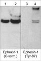 Western blot analysis of human A431 cells untreated (lanes 1 & 3) or treated with pervanadate (1 mM) for 30 min. (lanes 2 & 4). The blot was probed with anti-Ephexin-1 (C-terminal region) (lanes 1 & 2) and anti-Ephexin-1 (Tyr-87) (lanes 3 & 4).