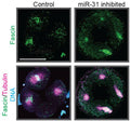 Sea urchin embryos were injected with control miR-124 LNA inhibitor or miR-31 LNA inhibitor and immunolabeled with Fascin antibody (Cat. FM2651, green) and tubulin antibody (magenta) followed by DAPI counterstain for DNA (blue). Image from publication CC-BY-4.0. PMID: 37398341