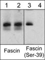 Western blot analysis of human HeLa cells treated with Calyculin A (100 nM) for 30 min (lanes 1 & 3) before treatment with lambda phosphatase (lanes 2 & 4). The blots were probed with anti-Fascin (clone 55K2) (lanes 1 & 2) and anti-Fascin (Ser-39) (lanes 3 & 4).