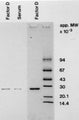 Western blot detection of Complement factor D using Anti-Complement Factor D Antibody (Cat. GAU 010-04-010). Gel was loaded with Lane 1: Purified Factor D, Lane 2: Factor D in human serum, Lane 3: SDS-PAGE purified Factor D. Proteins were transferred to the membrane, blocked, and then washed with a buffer. Primary antibody was incubated with sample and then detected via ECL using a secondary antibody.