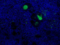 Immunofluorescent staining of Complement C3a in plasma of nephritis human kidney using Anti-Complement C3a/C3a(desArg)/C3 Antibody (Cat. GAU 013-16-010). Cells where fixed with formaldehyde and permeabilized prior to staining Primary antibody (GAU 013-16-010) was incubated with the cells at a dilution of 1:75.