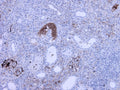 Immunohistochemistry detection of Complement C3a/C3a/(desArg)/C3 in human kidney tissue using Anti-Complement C3a/C3a(desArg)/C3 Antibody (Cat. GAU 013-16-010). Tissue was mounted and pariffin fixed. Heat induced antigen retrieval was performed using citrate buffer, heated, and then blocked. After washing, the primary antibody (Cat. GAU 013-16-010) was incubated with the sample at a dilution of 1:150. Strong staining of veins of nephritis kidney was seen.