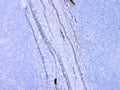 Immunohistochemistry detection of Complement C3a/C3a/(desArg)/C3 in human tonsil tissue using Anti-Complement C3a/C3a(desArg)/C3 Antibody (Cat. GAU 013-16-010). Tissue was mounted and pariffin fixed. Heat induced antigen retrieval was performed using citrate buffer, heated, and then blocked. After washing, the primary antibody (Cat. GAU 013-16-010) was incubated with the sample at a dilution of 1:150. Plasma in lumen of veins is stained strongly in tonsil.