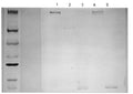 Western blot detection of Complement C3a/C3a/(desArg)/C3 using Anti-Complement C3a/C3a(desArg)/C3 Antibody (Cat. GAU 013-16-010). Gel was loaded with Lane 1: Purified C3, Lane 2: Purifed C3 reduced/DTT, Lane 3: Purified C3a, Lane 4: EDTA-plasma, Lane 5: Zymosan-activated serum. Proteins were transferred to the membrane, blocked, and then washed with a buffer. Primary antibody was incubated with sample and then detected via ECL using a secondary antibody.