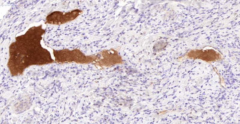 Immunohistochemistry detection of Complement C3a/C3a/(desArg)/C3 in human appendix tissue using Anti-Complement C3a/C3a(desArg)/C3 Antibody (Cat. GAU 017-01B-015). Tissue was mounted and pariffin fixed. Heat induced antigen retrieval was performed using citrate buffer, heated, and then blocked. After washing, the primary antibody (Cat. GAU 017-01B-015) was incubated with the sample at a dilution of 1:30. Plasma of veins stained strongly.