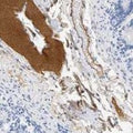 Immunohistochemistry detection of Complement factor H (ß1H-globulin) in Human duodenum tissue using Anti-Complement Factor H (beta-1H-Globulin) Antibody (Cat. GAU 018-03-010). Tissue was mounted and pariffin fixed. Heat induced antigen retrieval was performed using citrate buffer, heated, and then blocked. After washing, the primary antibody (Cat. GAU 018-03-010) was incubated with the sample.
