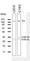 Western blot detection of Complement factor H (ß1H-globulin) using Anti-Complement Factor H (beta-1H-Globulin) Antibody (Cat. GAU 020-03-010). Gel was loaded with Lane 1: human serum. Proteins were transferred to the membrane, blocked, and then washed with a buffer. Primary antibody was incubated with sample and then detected via ECL using a secondary antibody.