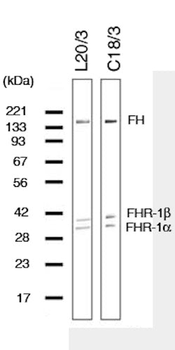 Western blot detection of Complement factor H (ß1H-globulin) using Anti-Complement Factor H (beta-1H-Globulin) Antibody (Cat. GAU 020-03-010). Gel was loaded with Lane 1: human serum. Proteins were transferred to the membrane, blocked, and then washed with a buffer. Primary antibody was incubated with sample and then detected via ECL using a secondary antibody.