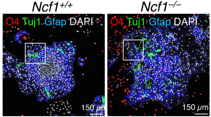 Immunofluorescent staining of WT or Ncf1–/– mouse neuronal stem cells (NSCs) for Olig 4 (O4), ßIII Tubulin (Tuj1) and Gfap (cat. GFAP, 1:250). Image from publication CC-BY-4.0. PMID: 36707536