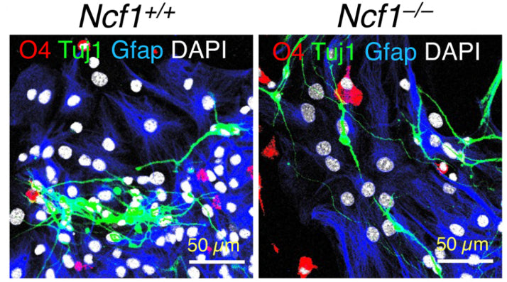 High manification view of immunofluorescent staining of WT or Ncf1–/– mouse neuronal stem cells (NSCs) for Olig 4 (O4), ßIII Tubulin (Tuj1) and Gfap (cat. GFAP, 1:250). Image from publication CC-BY-4.0. PMID: 36707536