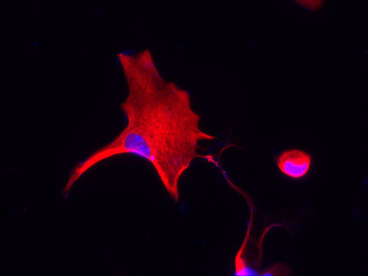 Immunostaining of astrocytes isolated from mouse cortex showing specific detection of GFAP (cat. GFAP, 1:500, red). Nuclei are labeled with DAPI (blue). Image kindly provided by Haofei Ni, Icahn School of Medicine at Mount Sinai.