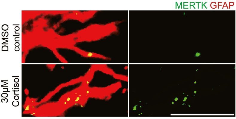 Representative confocal z stack images and bar graphs showing MERTK (green) expression in control and hCOs astrocytes (GFAP) (cat. GFAP, 1:1000; red). Image from publication CC-BY-4.0. PMID:37527657
