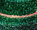Immunostaining of rat hippocampus CA1 region identifying NeuN (red), IBA1 (green), and GFAP (Cat. GFAP, 1:4000, cyan). The 30 um free-floating PFA-fixed tissue was embedded with Prolong Diamond with DAPI (grey). 10x image. Image kindly