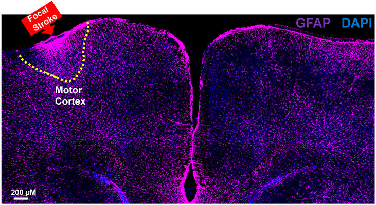GFAP (pink, 1:500, Cat no GFAP) and DAPI (blue) staining were conducted on C57BL/6J mice at P35, two days after inducing a focal stroke in the motor cortex. The image depicts local upregulation of GFAP+ astrocytes in the motor cortex. Image kindly provided by Moawiah Naffa'A, Ph.D., Duke University, Neurobiology.