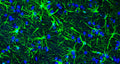 Representative section of formalin fixed, paraffin-embedded rat brain showing staining of GFAP. The sections were stained with Aves Labs anti-GFAP antibody (visualized in green)  (Cat. GFAP) at 1:500 dilution. The stained sections were mounted with Antibodies Incorporated FluoroshieldTM with DAPI and DABCO mounting medium (Cat. AR-6505). DAPI nuclear stain (blue) shows cell nuclei. Anti-GFAP specifically stains the astrocytes in the rat brain.